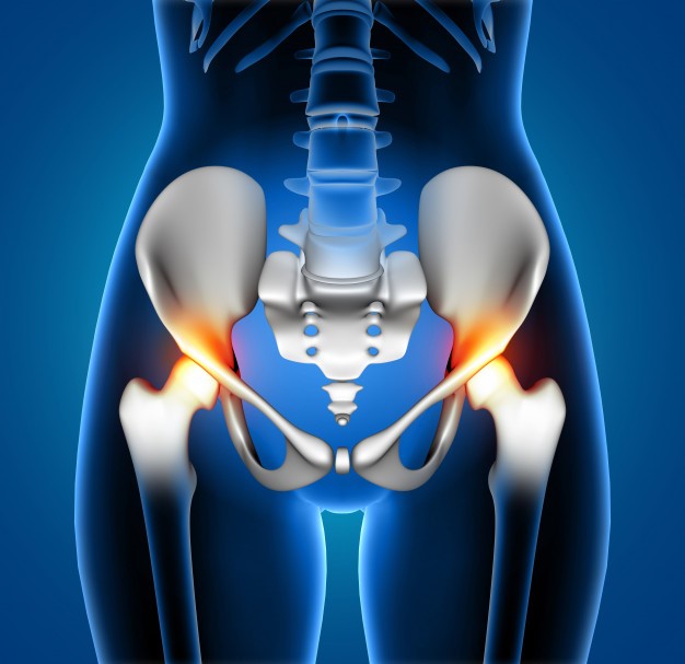 hip joint injury