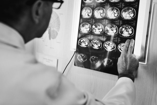 a neurologist examining a patient’s brain activity prior to focused ultrasound therapy for tremors