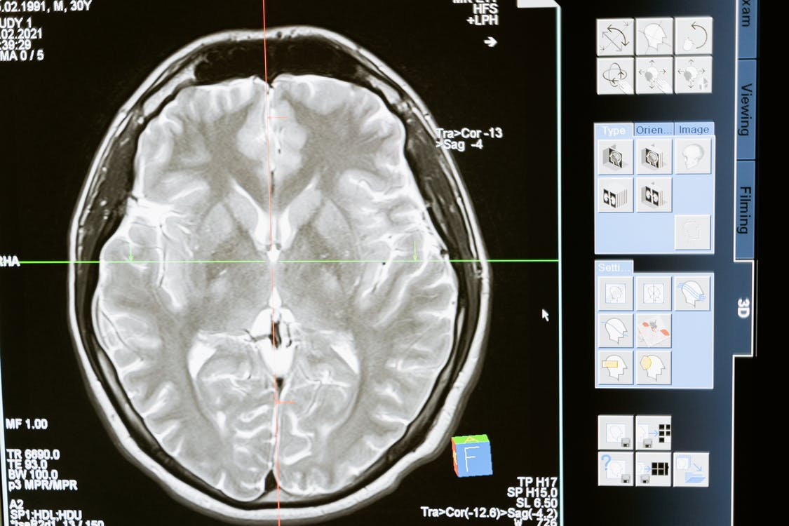 imaging test results