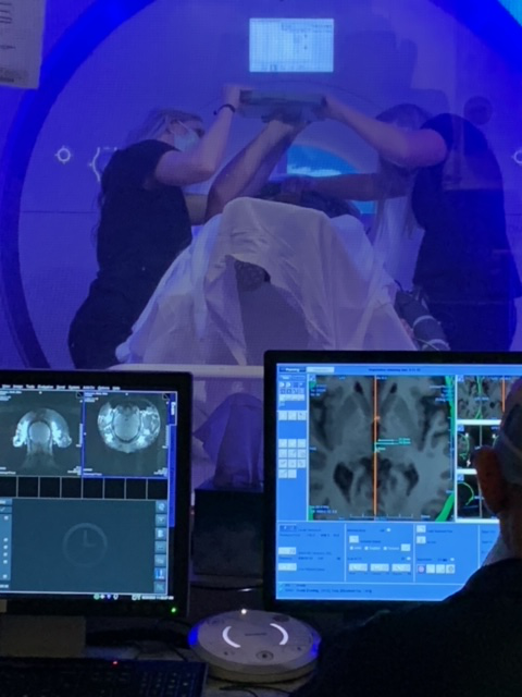 Medical professionals working with a patient in an MRI suite undergoing MR-focused treatment for essential tremor.