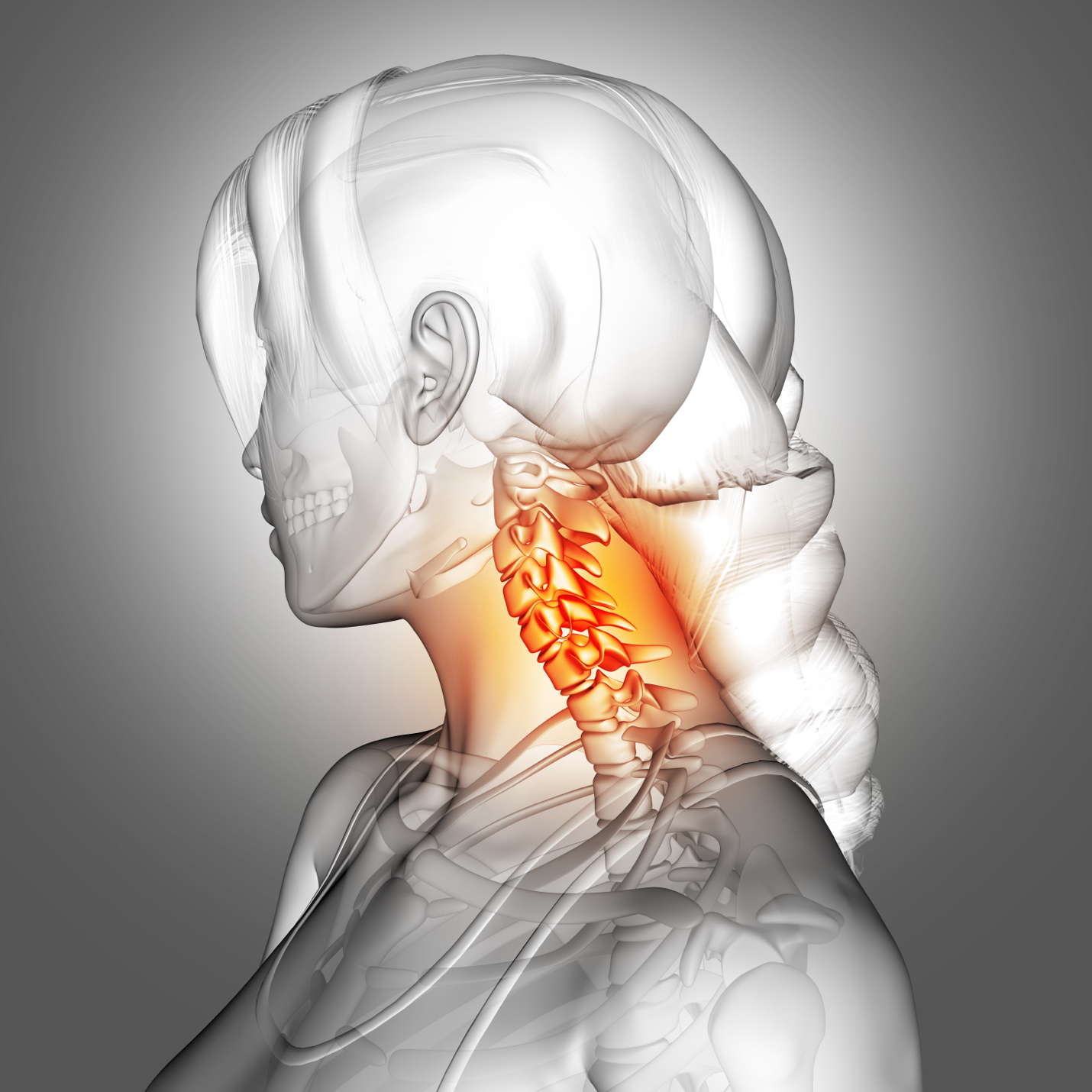 A 3D female figure with the cervical spine near the head highlighted in reddish orange.