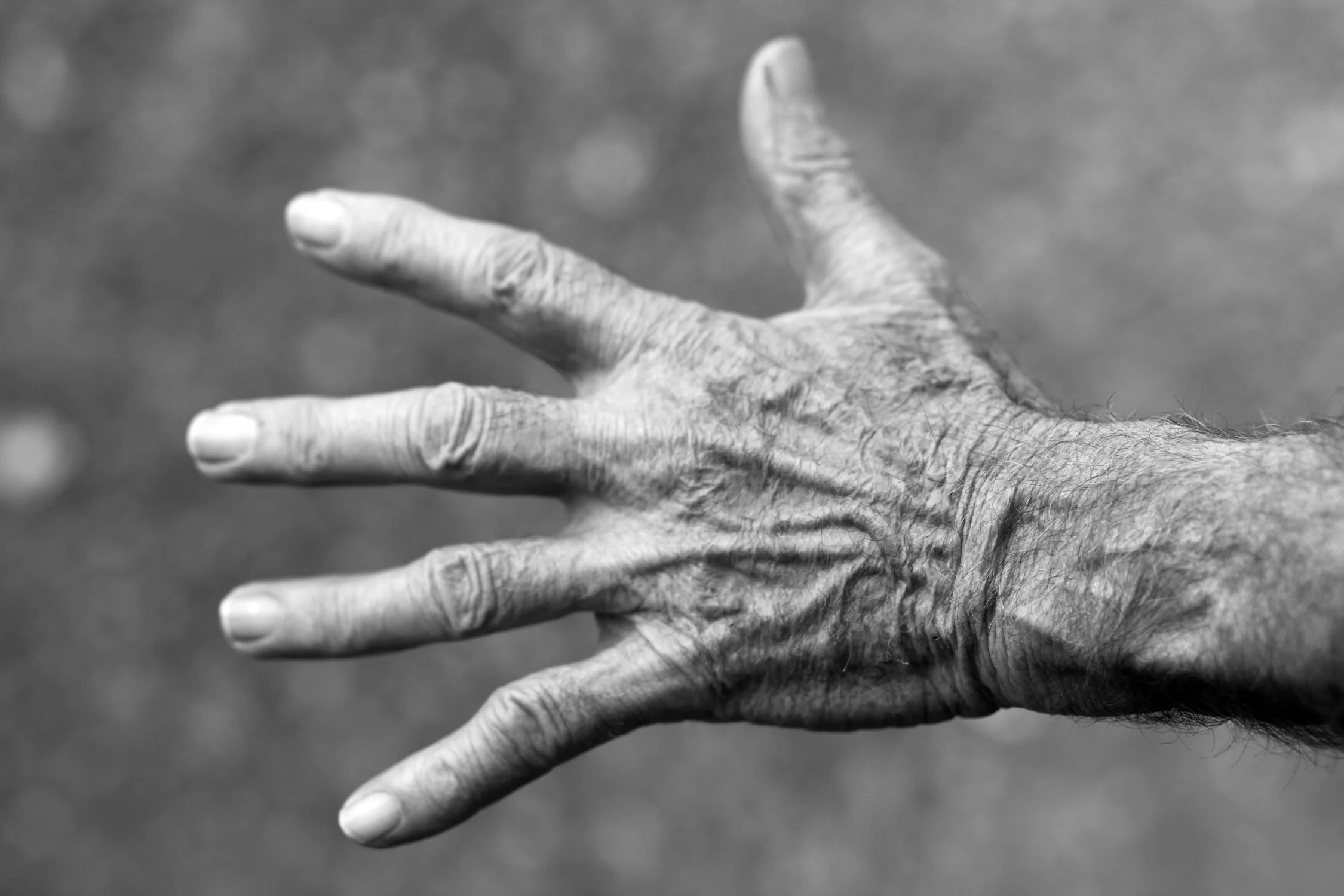 An elderly patient’s hand