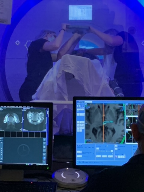 A patient lies in an MRI machine undergoing Insightec treatment for his essential tremor.