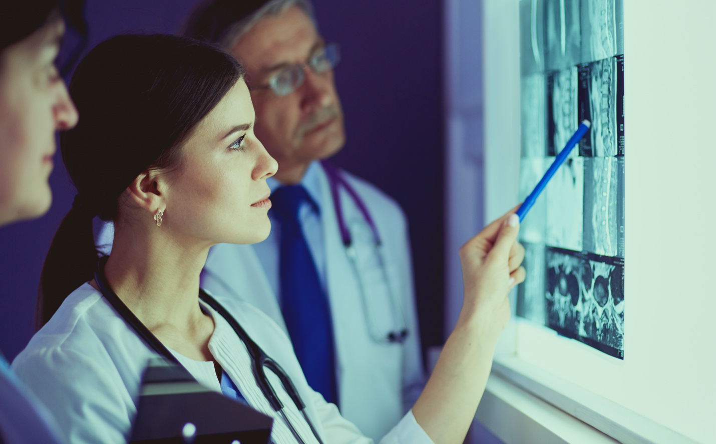 Three doctors looking at an X-ray of a spinal column.